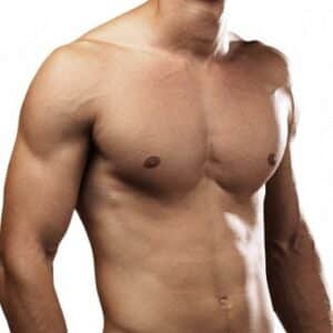 New York Gynecomastia