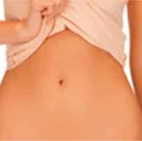 liposuction ladies