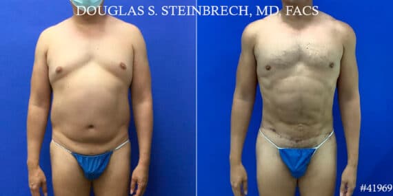 Body Banking Photos - Page 3 of 6 - Dr. Douglas Steinbrech