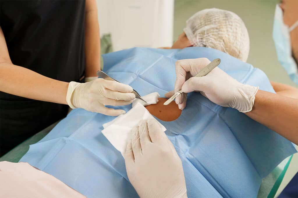 A doctor and nurse performing a Mohs procedure in New York