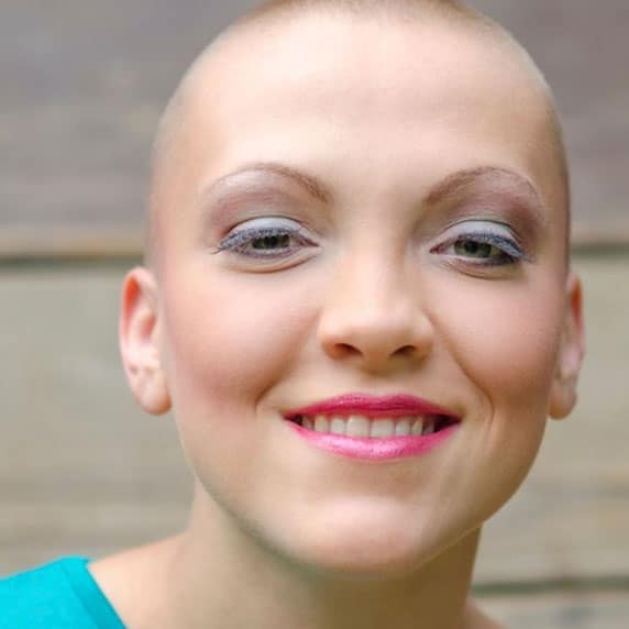 A cancer survivor after Mohs procedure recovery