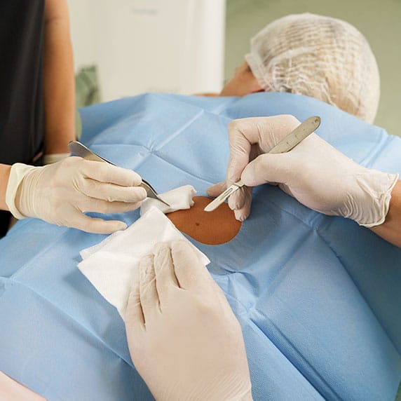 A doctor and nurse performing a Mohs procedure in New York