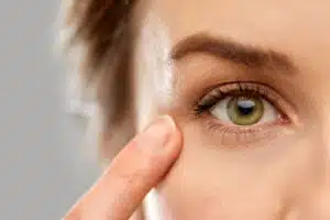 The recovery time for eyelid surgery is typically quicker than other facial surgeries, which means you can enjoy the results of your procedure sooner.