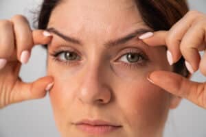 Blepharoplasty can also be combined with other facial procedures such as a brow lift and mid-face lift for an even more dramatic result.