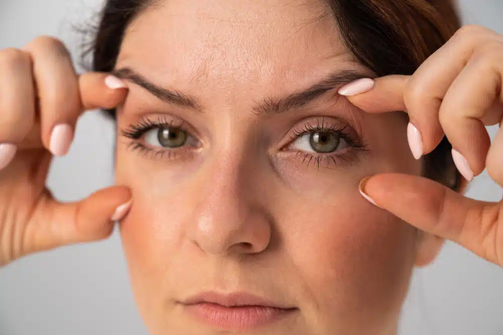 Blepharoplasty can also be combined with other facial procedures such as a brow lift and mid-face lift for an even more dramatic result.