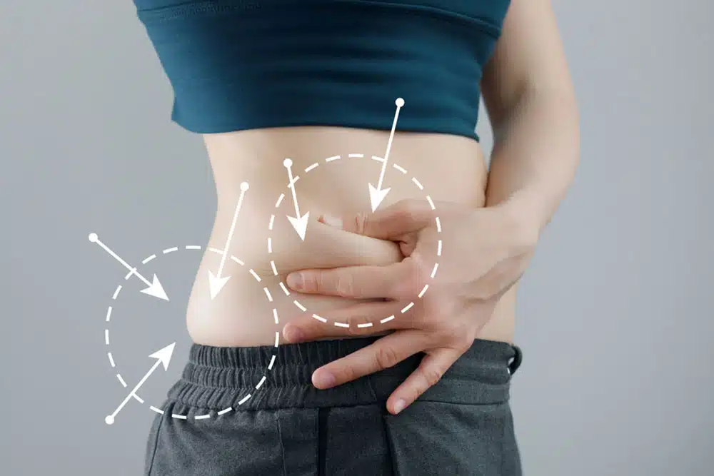 Kybella for Stomach Fat: Effective Treatment to Eliminate Belly Fat