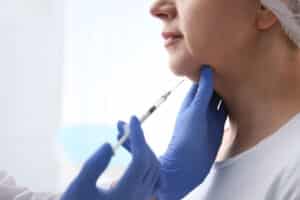 The most common Kybella side effect is temporary numbness or tingling in the chin area
