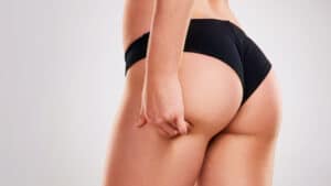 Dr. Steinbrech provides a guide about how brazilian butt lift is done in NY.