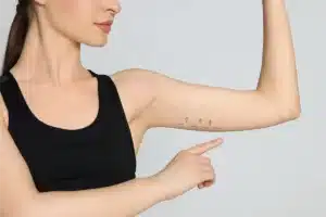 Patients can expect minimal downtime and a swift recovery process after undergoing the invisible arm lift surgery, resulting in sleeker, more youthful-looking arms.