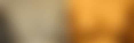 Breast Augmentation Before and After Photos in New York, NY, Patient 10780