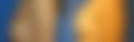 Breast Augmentation Before and After Photos in New York, NY, Patient 10780