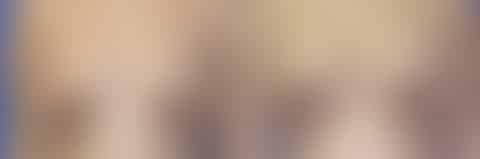 Breast Lift Before and After Photos in New York, NY, Patient 10961