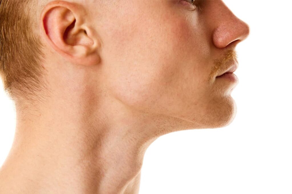 A side profile view of a man's face showing a sharp, angular jawline and a defined neck area.