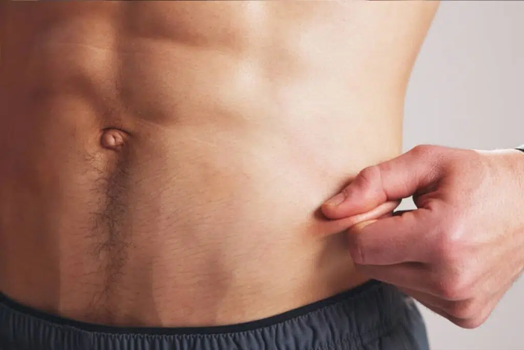A close-up of a man's midsection as he pinches a small amount of excess skin on his lower abdomen to demonstrate surgical goals.